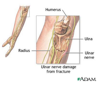 de o lună acum brațul articulației cotului doare medicament pentru boli ale articulațiilor picioarelor