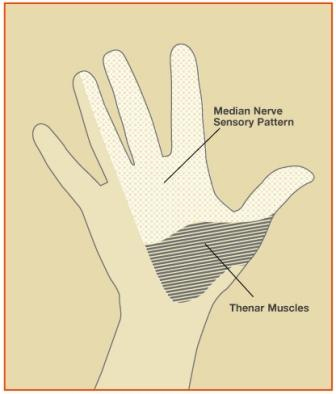 Sindromul de tunel carpian – amortirea frecventa a mainilor - Farmacia Alphega